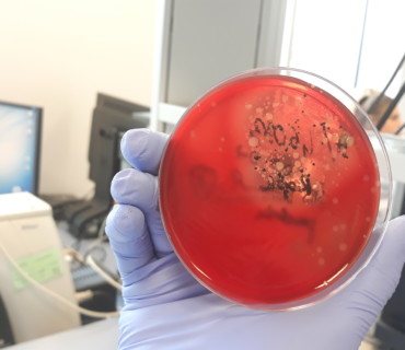 Identyfikacja baketrii
